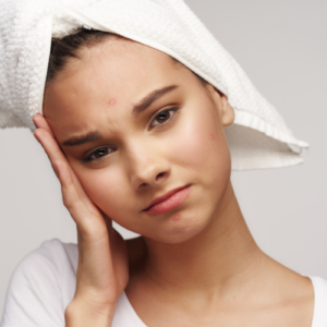 Read more about the article Which Face Wash is Best for Pimples and Dark Spots?